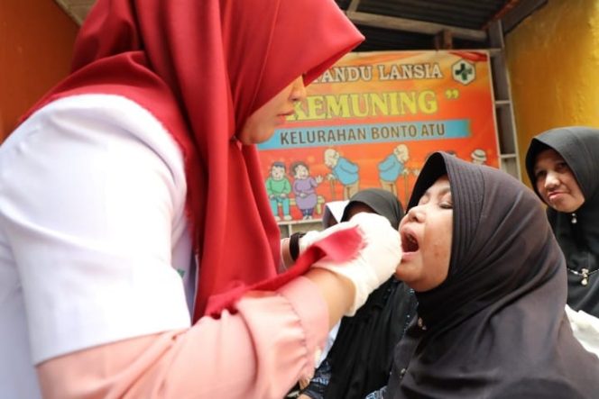 					Pemkab Bantaeng Bersama Unhas Gelar Pemasangan Gigi Palsu Lansia