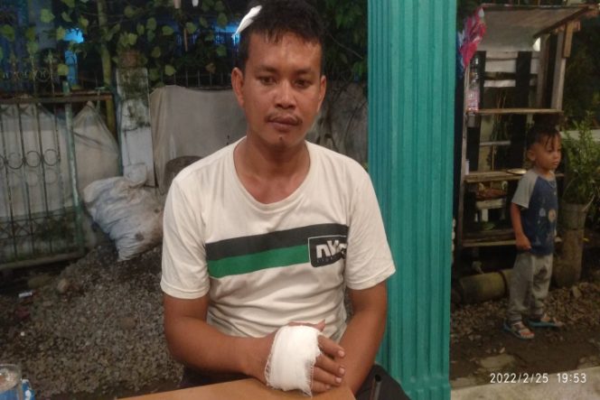 					Akbar (31) Warga Kabupaten Gowa yang dianiaya Geng Motor Pelor. (Foto: Kadir). 