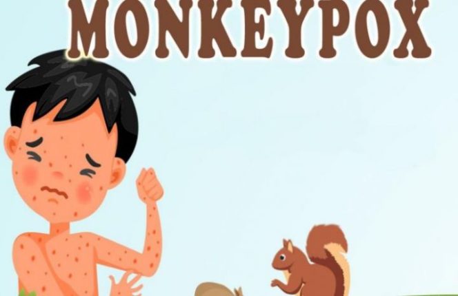 					Ilustrasi Cacar Monyet atau Mongkeypox (Ist Kemenkes)