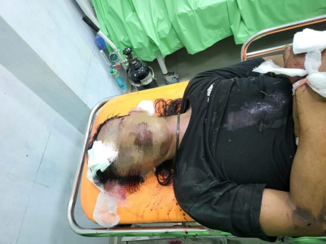 					Jenazah Korban saat Dievakuasi di RSUD Lanto Dg Pasewang Jeneponto. (Dok. Ist/ Humas)