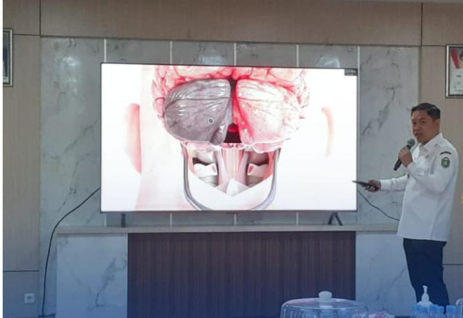 					Dirut RS HAH Parepare, dr Mahyuddin Rasyid Menerangkan Proses Bedah Otak. (Foto: Istimewa)