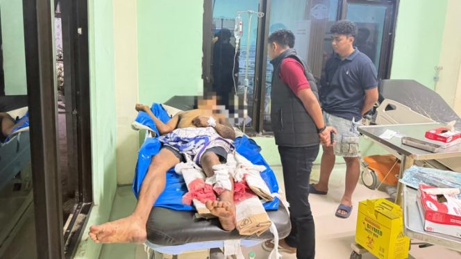 					Terduga Pelaku Curanmor Menjalani Perawatan Medis di RSUD Bulukumba Usai Alami Kecelakaan. (Foto: Ist)